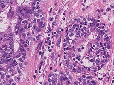 Image for Digital Pathology Market – Trends, 2025 with ID of: 2044269