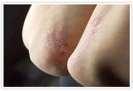 Image for Forward Clinical Trials with ID of: 2053134