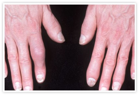 Image for Forward Clinical Trials with ID of: 2053135