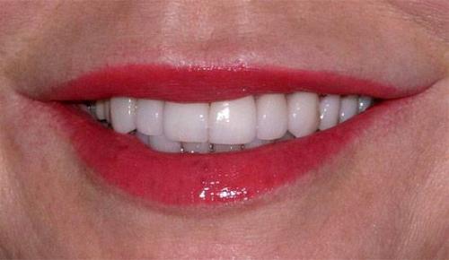 Image for Nashville Restorative Dentistry with ID of: 2090925