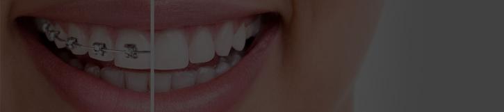 Image for Somerset Orthodontics with ID of: 2093796