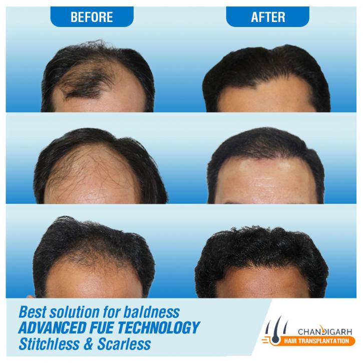 Image for MEN HAIR TRANSPLANT with ID of: 2112260
