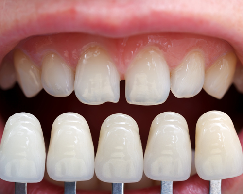Image for Somerset Dental with ID of: 2116352