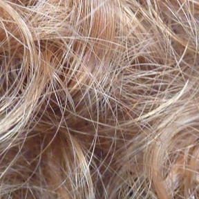 Image for Hair Transplant Phoenix with ID of: 2119007