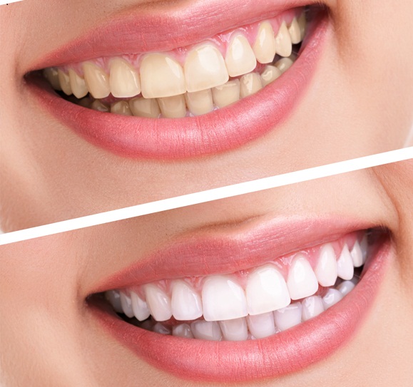 Image for Dental Care Somerset with ID of: 2122582