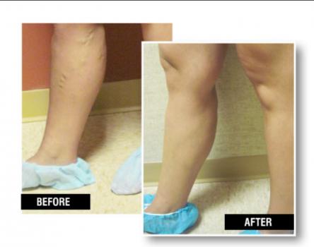 Image for USA Vein Clinics with ID of: 2133239