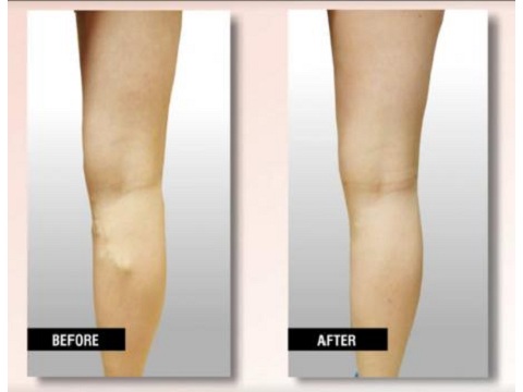Image for USA Vein Clinics with ID of: 2133501