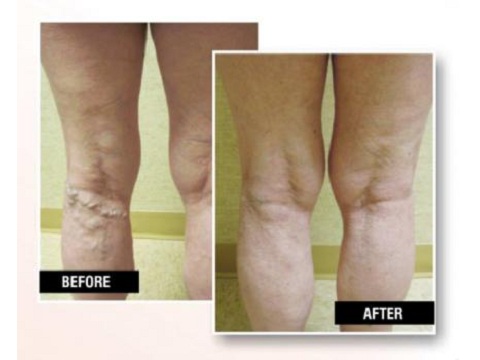 Image for USA Vein Clinics with ID of: 2133505