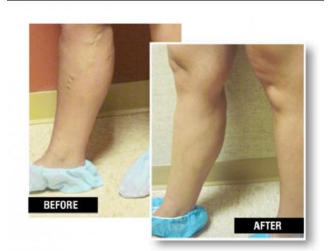Image for USA Vein Clinics with ID of: 2133506
