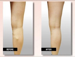 Image for USA Vein Clinics with ID of: 2133554