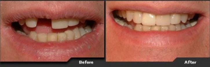 Image for TLC Dental with ID of: 2139155