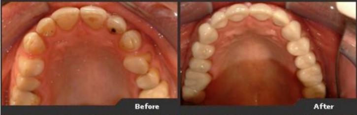 Image for TLC Dental with ID of: 2139161