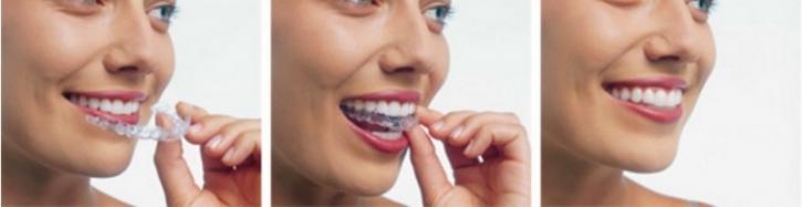 Image for TLC Dental with ID of: 2139163