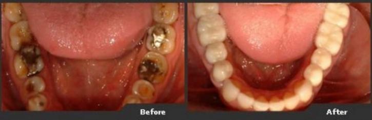 Image for TLC Dental with ID of: 2139164