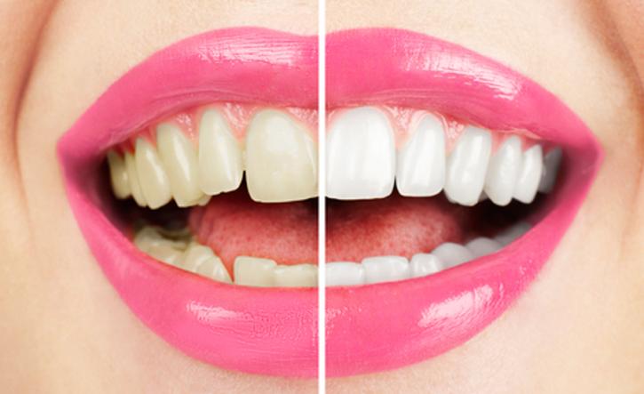 Image for Somerset Orthodontics with ID of: 2143725