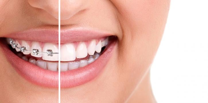 Image for Somerset Orthodontics with ID of: 2172543