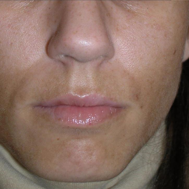 Image for Cover Slim with ID of: 2184323