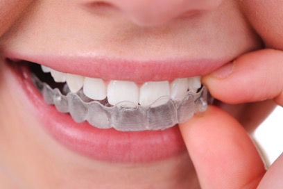 Image for Anderson Dental with ID of: 2187149