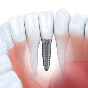 Image for Magnolia Dental with ID of: 2189967