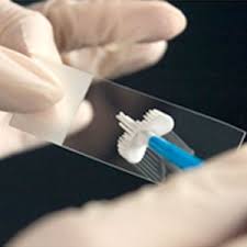 Image for Global HPV Testing Market Analysis & Outlook to 2022 with ID of: 2191709