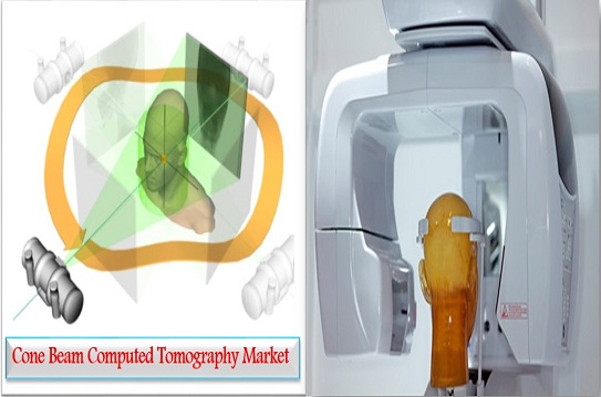 Image for Cone Beam Computed Tomography Market - By Product Type, Application, End User - Opportunity Analysis, 2025 with ID of: 2197185