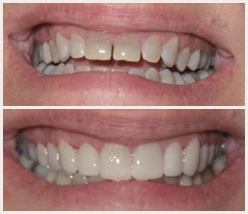 Image for Dental Implants with ID of: 2208263