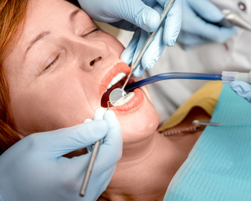 Image for Veneers in Somerset with ID of: 2228966