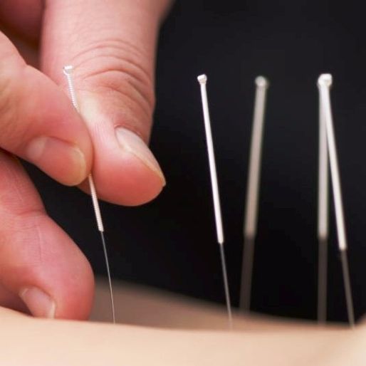 Image for A-Care Acupuncture & Health Center with ID of: 2230342