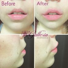 Image for Galleria Aesthetics with ID of: 2230352