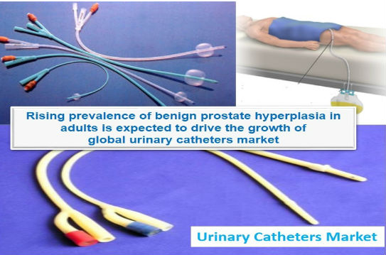 Image for Urinary Catheters Market - By Product Type, Application, End User - Opportunity Analysis, 2025 with ID of: 2235563