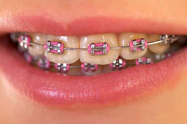 Image for Bigman Orthodontics with ID of: 2250843