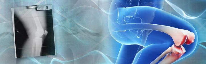 Image for Rheumatoid Arthritis Holds The Largest Share Due To High Prevalence Rate In The Rheumatology Therapeutics Market with ID of: 2263238