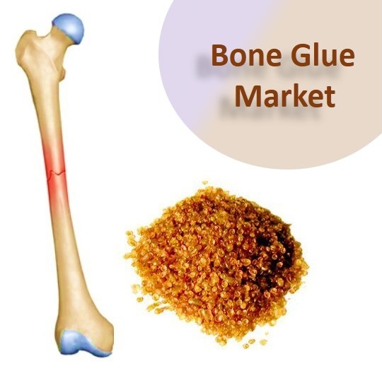 Image for Bone Glue: Cementing the Path to Effective Bone Healing with ID of: 2280689