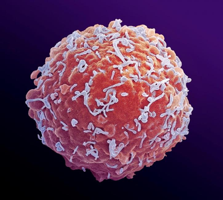 Image for Important Players Present In The Hematopoietic Stem Cell Transplantation Market with ID of: 2282967