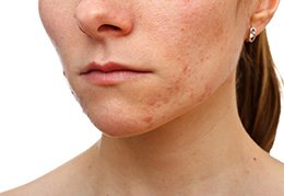Image for Manhattan Dermatology Specialists with ID of: 2292031