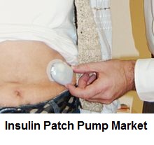 Image for Insulin Patch Pump Market Key Players and Industry Analysis 2025 with ID of: 2298713