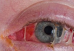 Image for Manhattan Eye Specialists with ID of: 2307454
