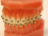 Image for Self Ligating Bracket Market: Less Pain Method. with ID of: 2315198