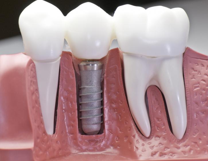 Image for Signature Smiles with ID of: 2322084