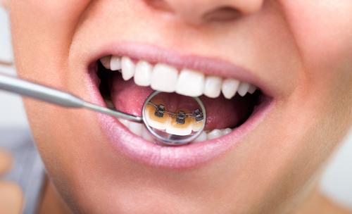 Image for Chase Orthodontics with ID of: 2366668