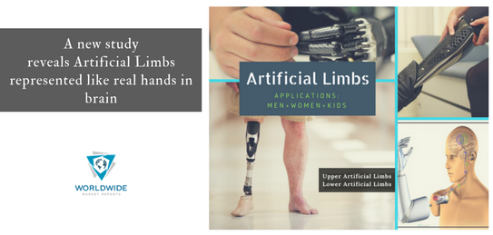 Image for Global Artificial Limbs Market Future and Technological Advancement 2022 with ID of: 2379530