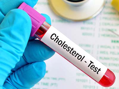 Image for Cholesterol Testing Services Market is expected to Garner US$ 22.6 Bn by 2025 with ID of: 2407002