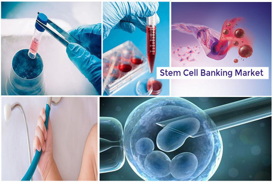 Image for Stem Cell Banking Market - Global Trends, Size, Share, Analysis and Forecast to 2025 with ID of: 2410035