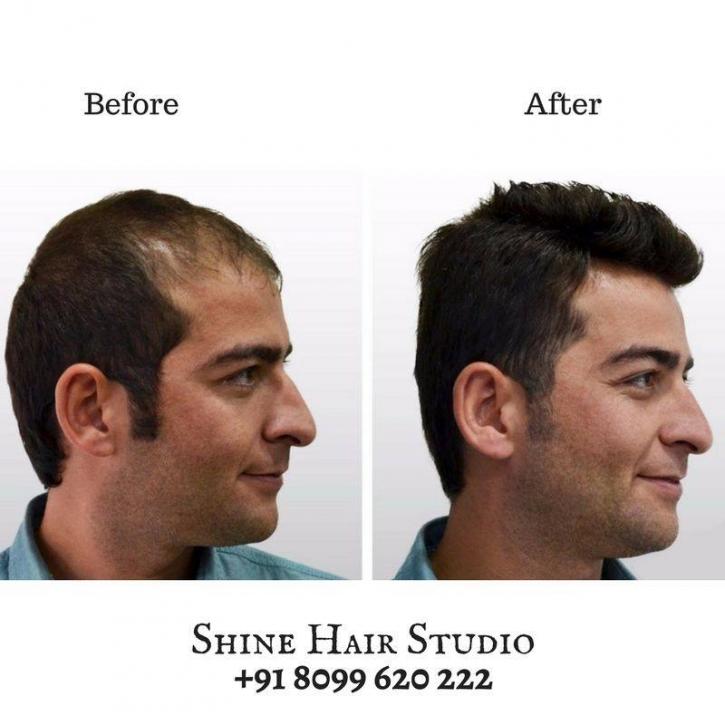 Image for Flat 20% off on Hair Service with ID of: 2435830