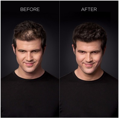 Image for Flat 20% off on Hair Service with ID of: 2435841
