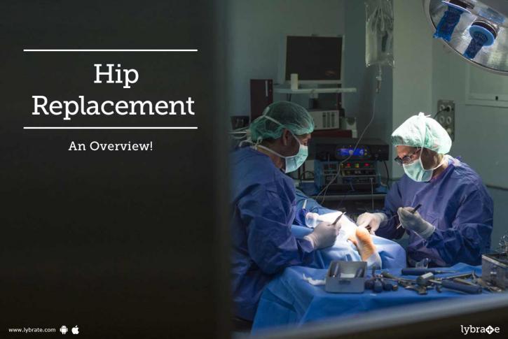 Image for total hip replacement surgery in delhi with ID of: 2438484
