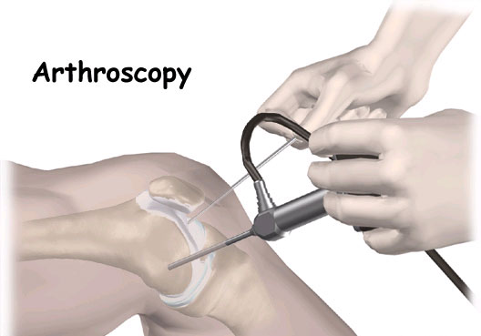Image for arthroscopy surgeon in delhi with ID of: 2438492