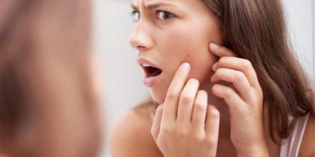 Image for ayurvedic treatment for pimples with ID of: 2438697