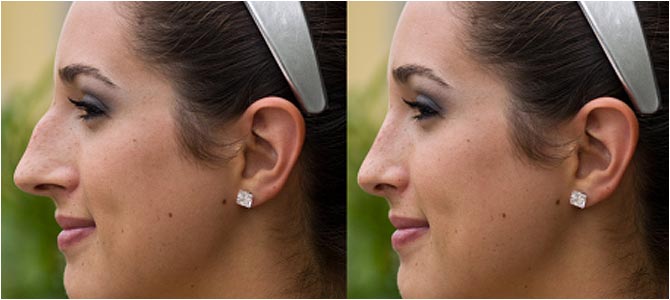 Image for Plastic Surgery SEO with ID of: 2449224