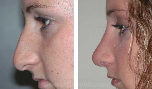Image for Plastic Surgery SEO with ID of: 2449229